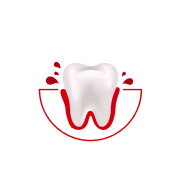 Hur ofta blöder det när du borstar tänderna eller använder tandtråd?