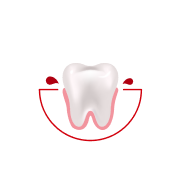 Hur ofta blöder det när du borstar tänderna eller använder tandtråd?