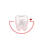 Hur ofta blöder det när du borstar tänderna eller använder tandtråd?