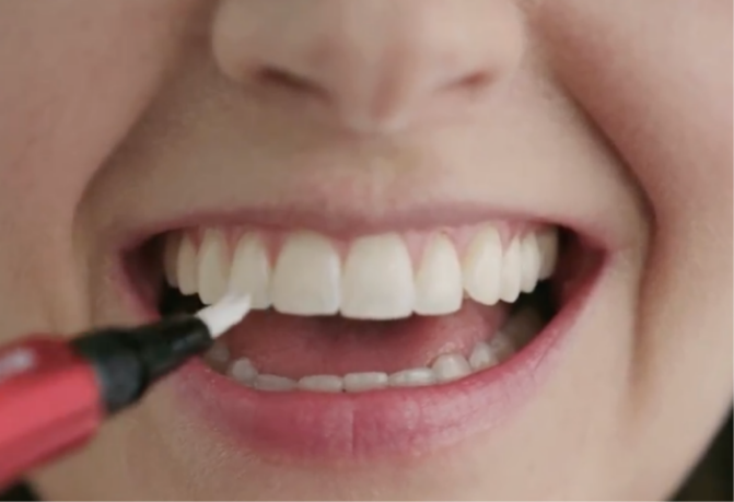Woman applying the Colgate Whitening Pen Woman applying the Colgate Whitening Pen